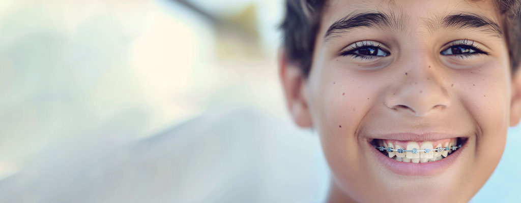 Festsitzende Zahnspange – Brackets und Bögen