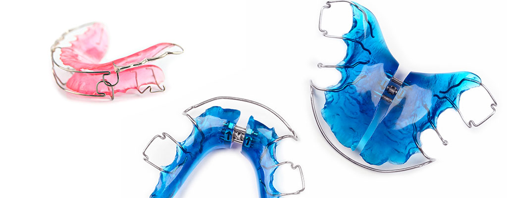 Herausnehmbare Zahnspange – Kieferorthopädie Dr. Winau